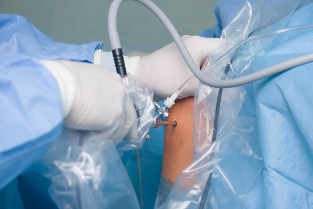 Artroscopia de joelho