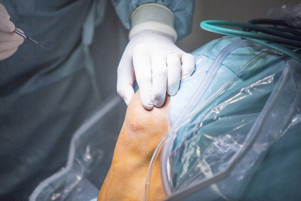 Cirurgia de menisco