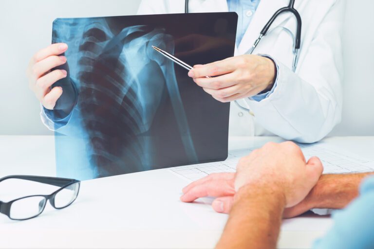 Médico mostrando o raio-x ao paciente.