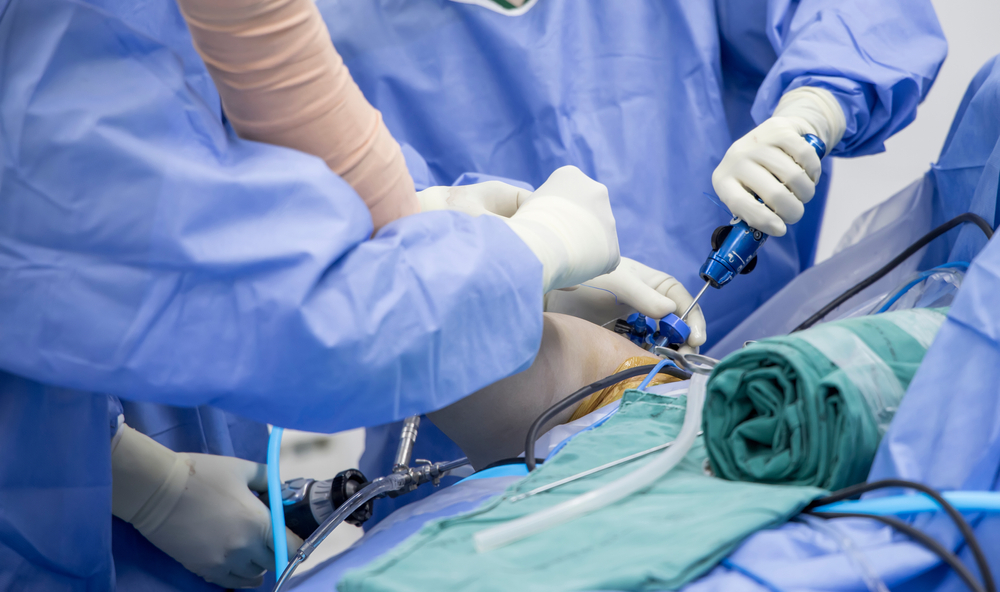 Cirurgia da tendinite no ombro