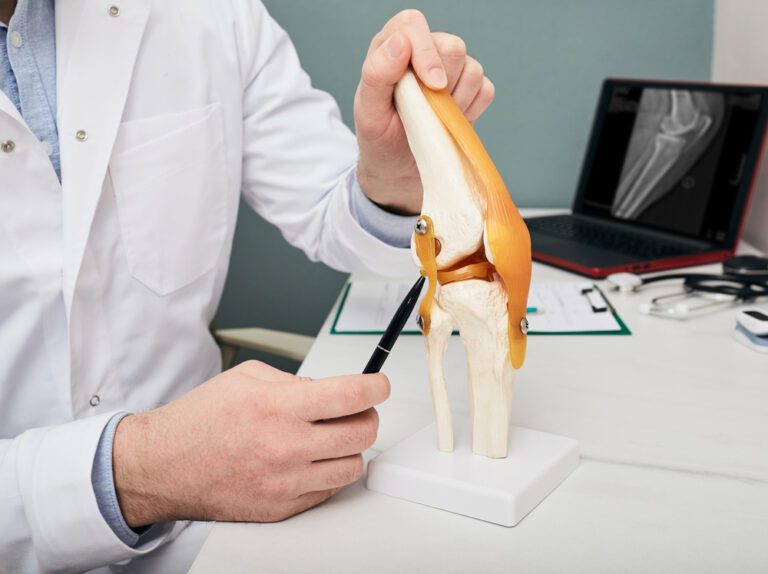 Médico com peça anatômica do ligamento cruzado anterior