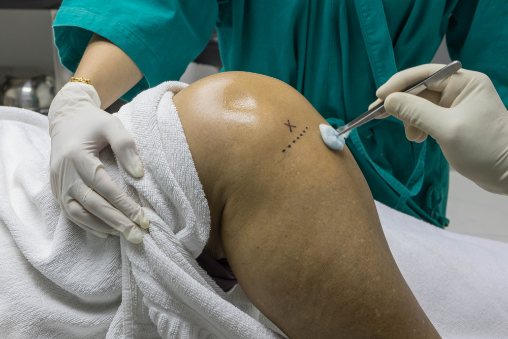 Infiltração do joelho: o que é, como é feita e quando é indicada?