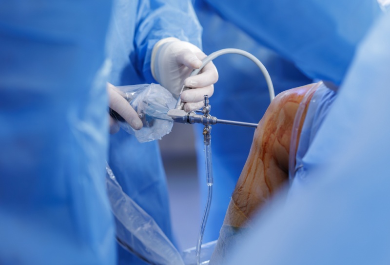 Artroscopia: o que é, como funciona e quando é indicada