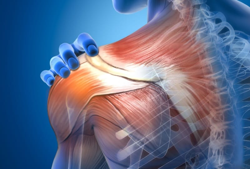 Artrose acromioclavicular: o que é, sintomas, tratamentos e causas