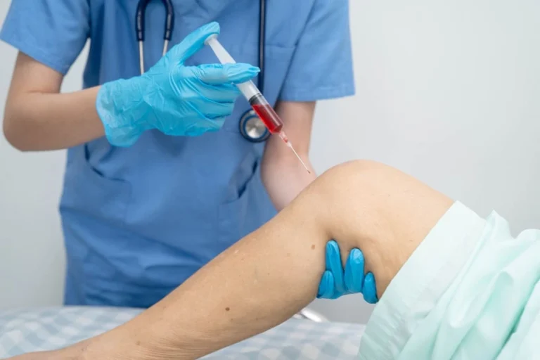 Médico injetando plasma rico em plaquetas de ácido hialurônico no joelho de mulher idosa. Esse é um dos tratamento indicado para infiltração no joelho.